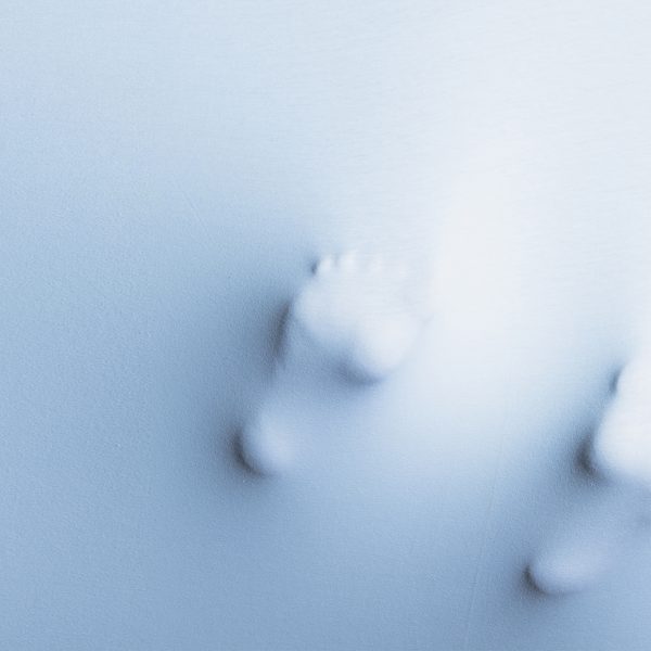 me sudan mucho los pies