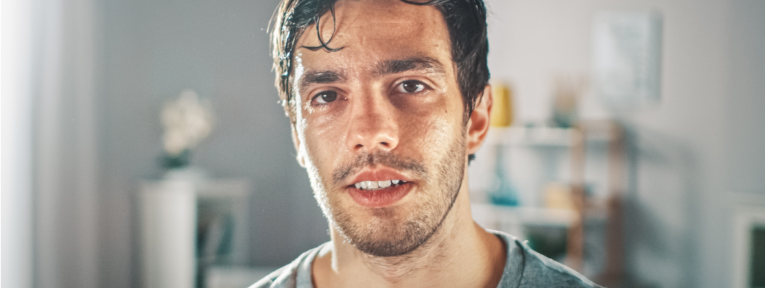 sudoración intensa o hiperhidrosis